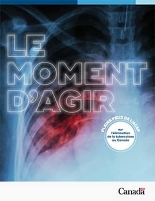 Appel à candidatures : 11ème cycle de subventions du Partenariat « Halte à la Tuberculose » pour la société civile