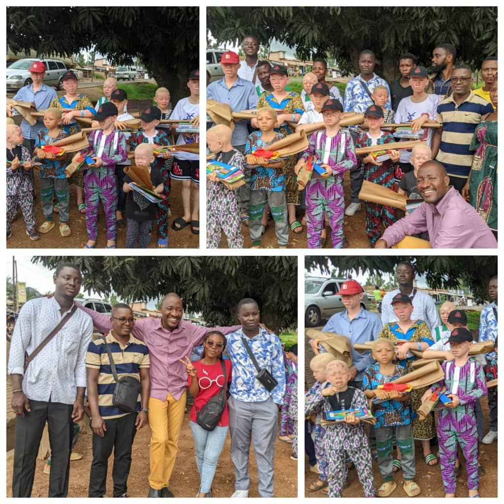 PRO.TO.P.A., EVA-Togo et de jeunes volontaires Togolais offrent des kits scolaires aux enfants albinos démunis à Atakpamé